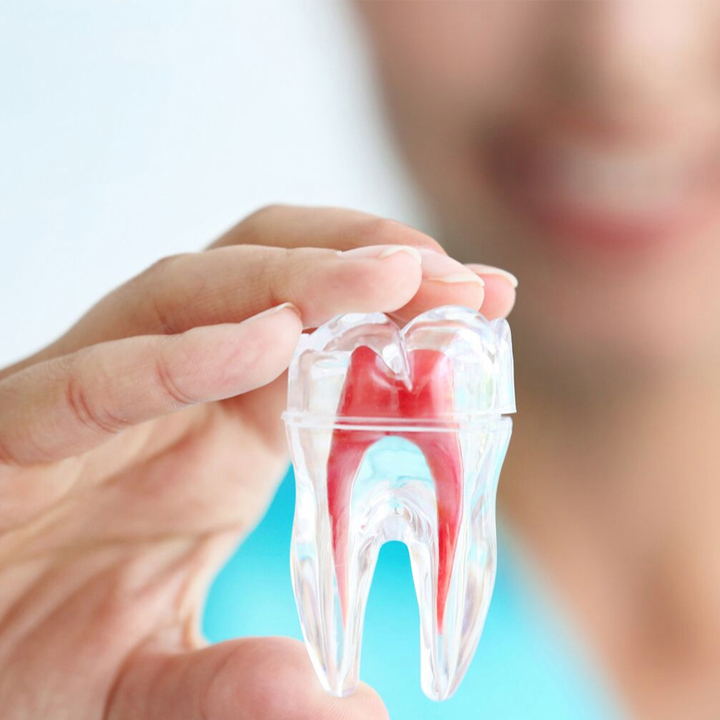 Root Canal Treatment
